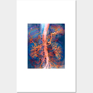 Abdominal arteries, X-ray (P206/0309) Posters and Art